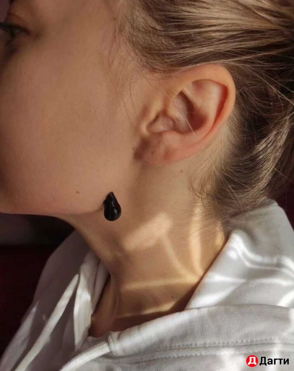 Пиявка медицинская.