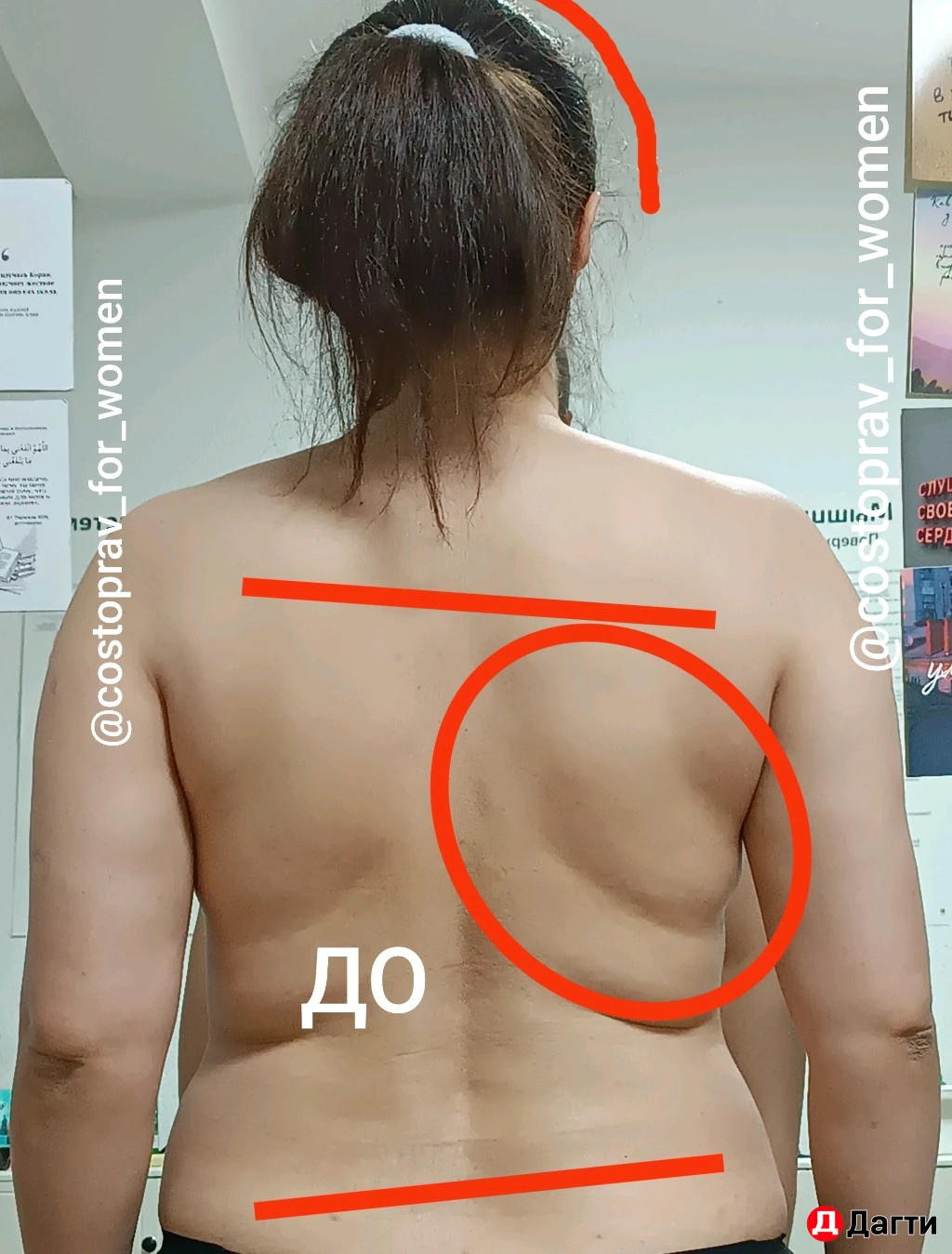 ЖЕНСКИЙ КОСТОПРАВ, МАНУАЛЬНЫЙ ТЕРАПЕВТ, ОСТЕОПАТ