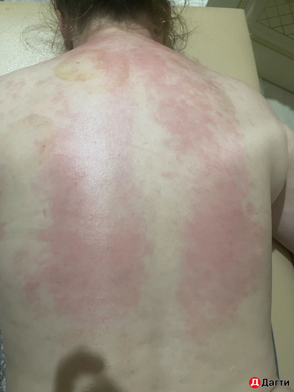 Массаж лица и тела