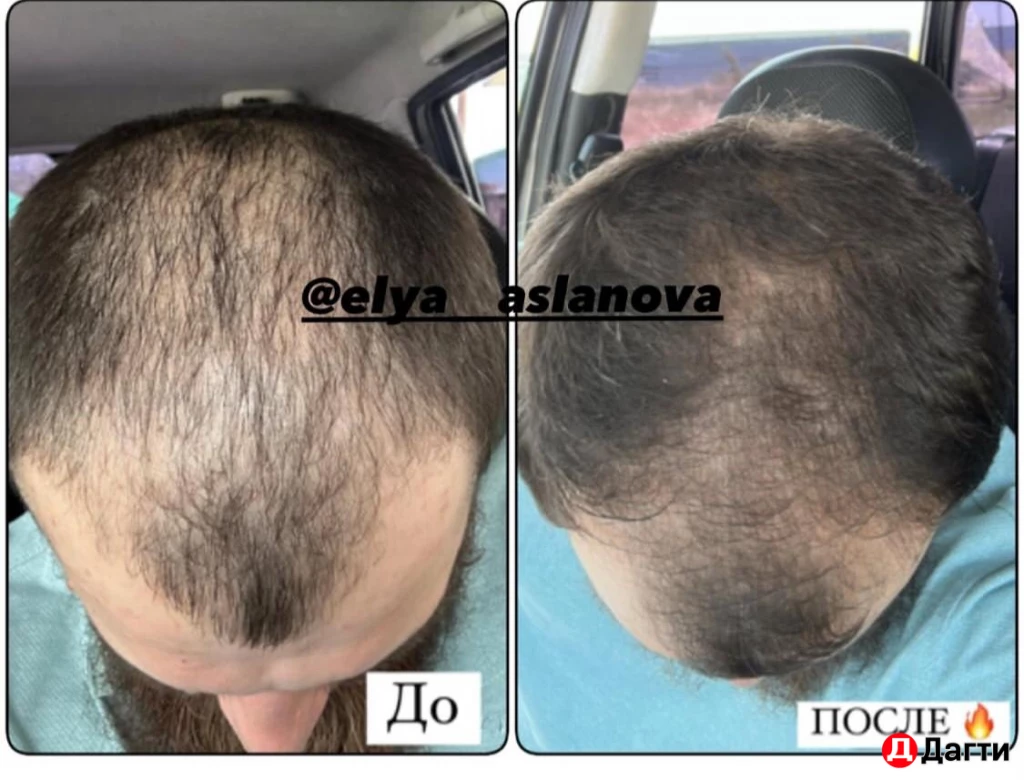 Отвар от выпадения волос