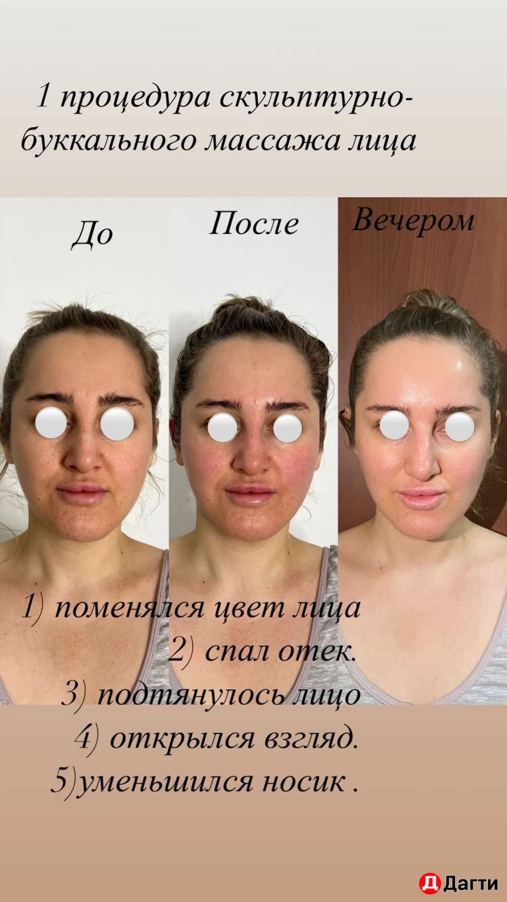 Массаж лица