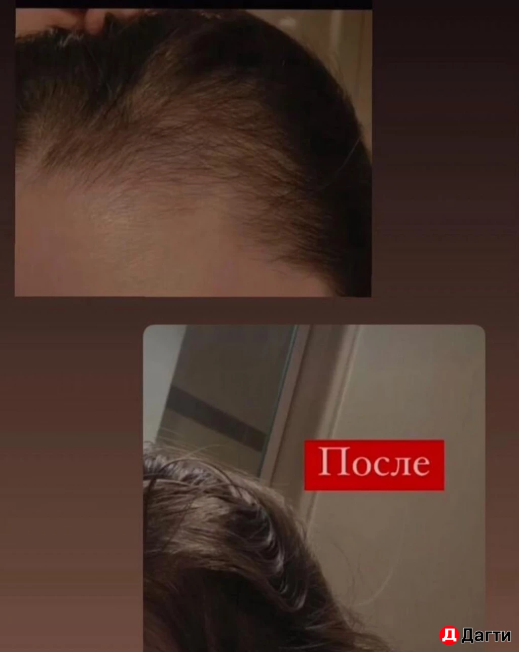 Отвар от выпадения волос