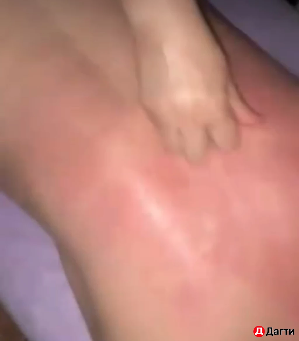 Массаж лица и тела