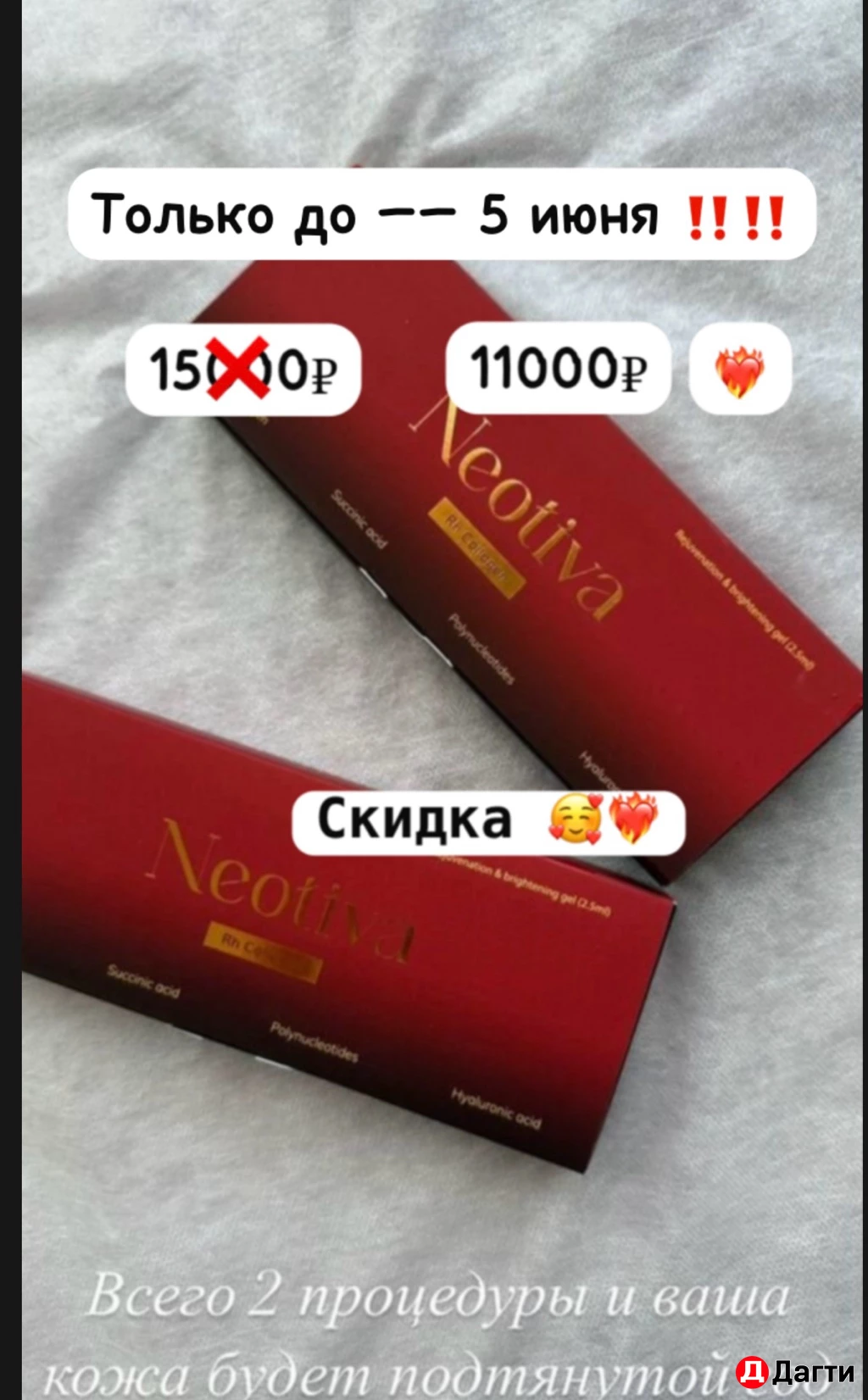 Биоревитализация
