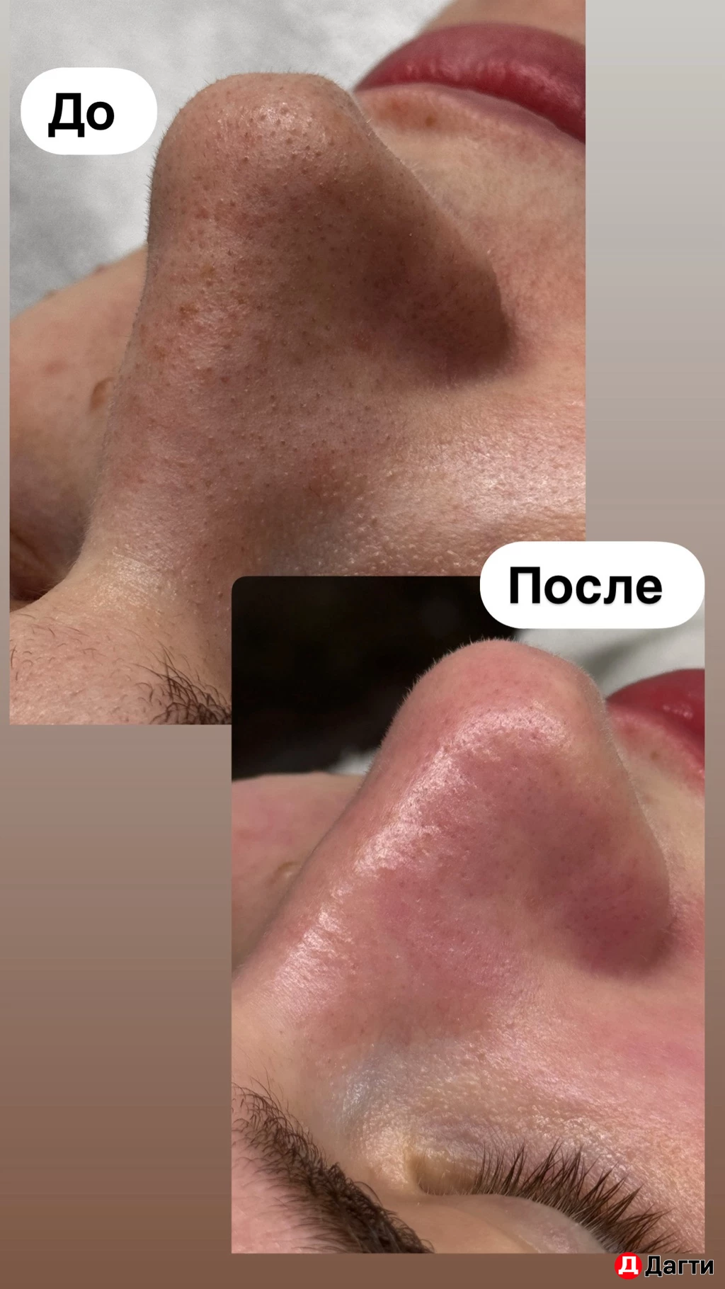 Уколы красоты