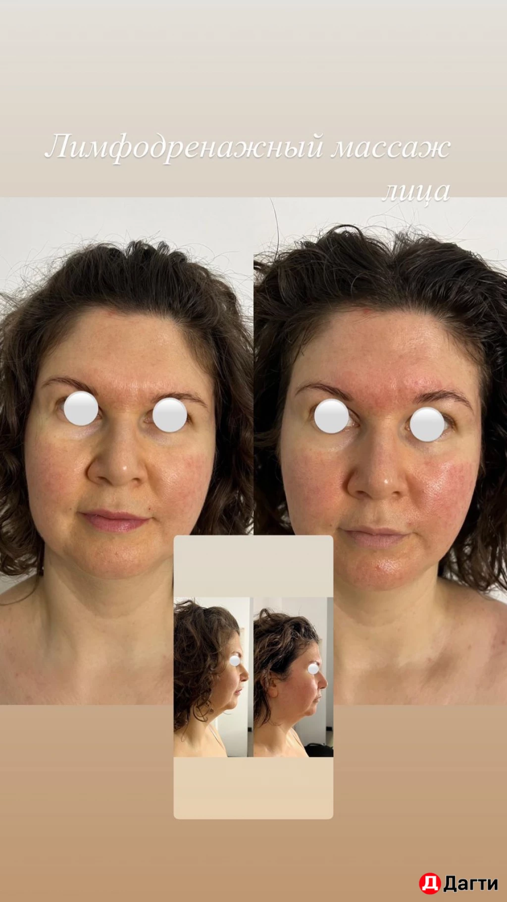 Массаж лица