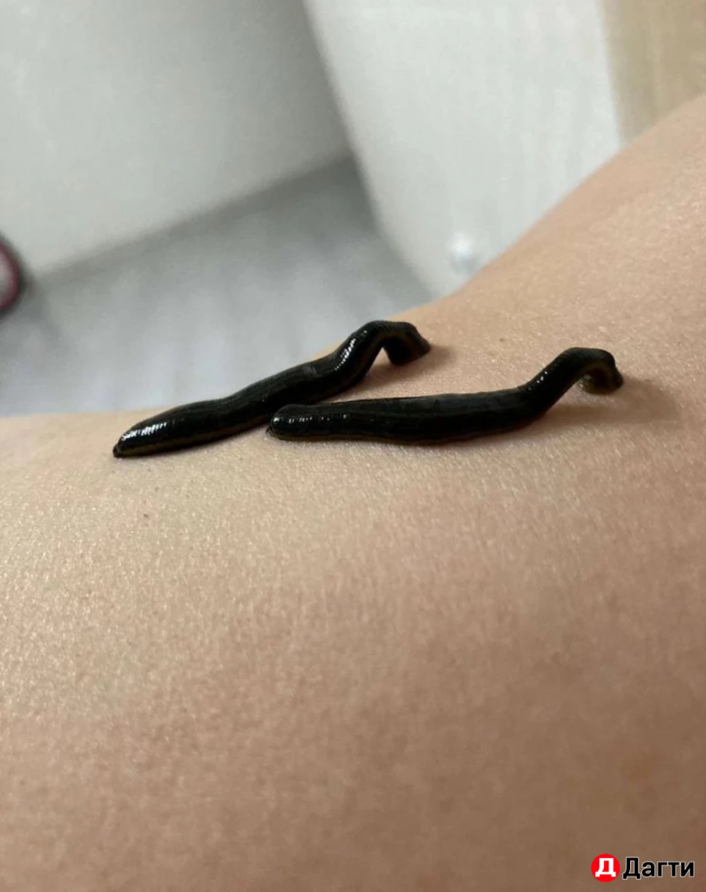 Пиявка медицинская.