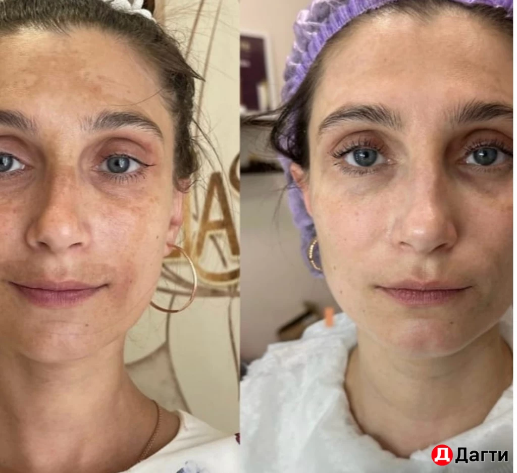 Уколы красоты