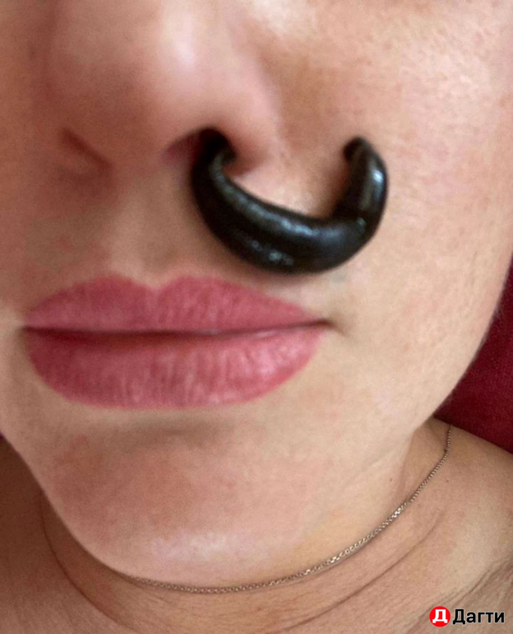 Пиявка медицинская.