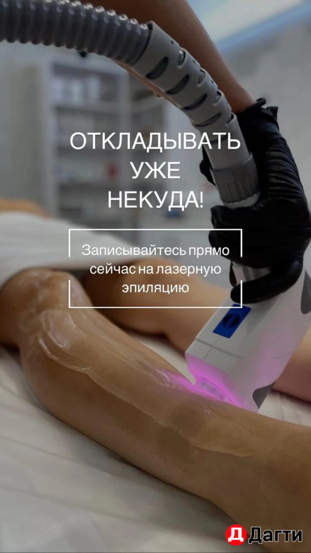 Лазерная эпиляция