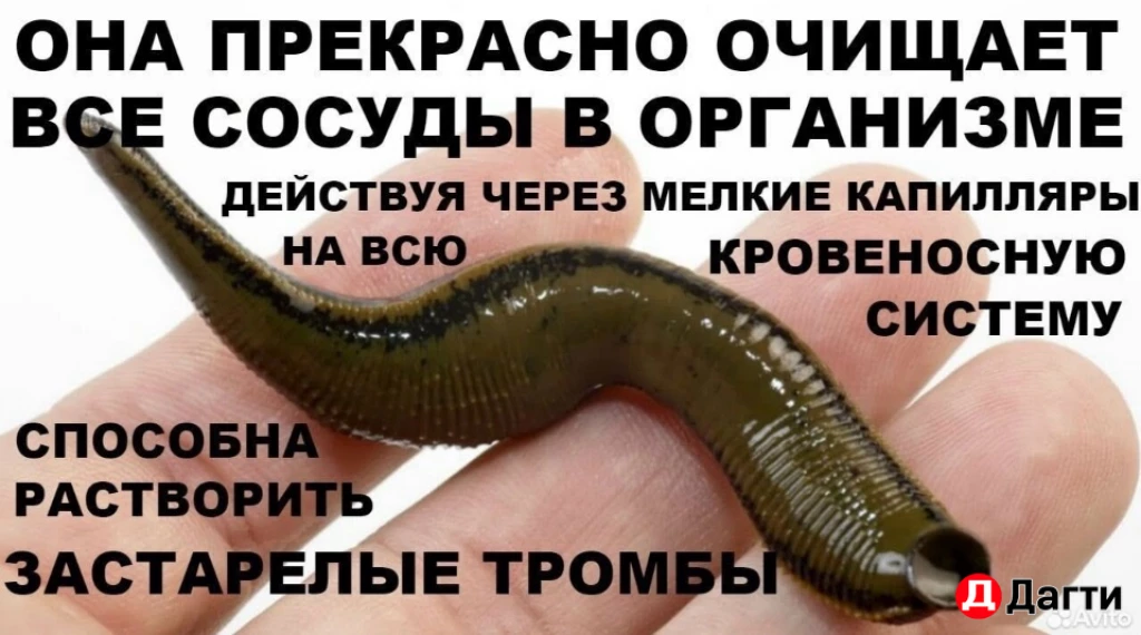 Пиявка медицинская.