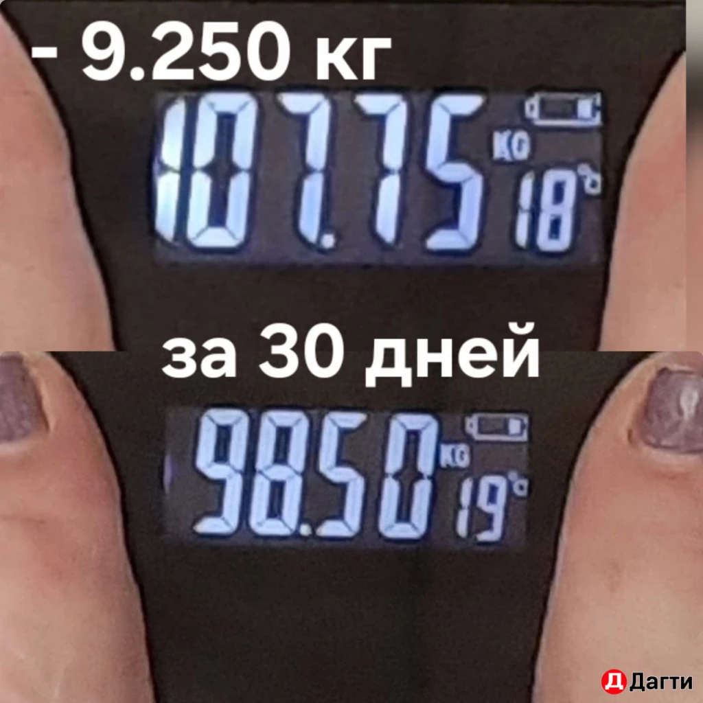 Аппаратный массаж / LPG / Снижение веса