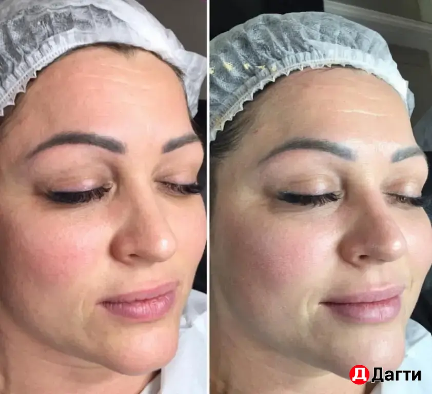 нужны модели косметологу