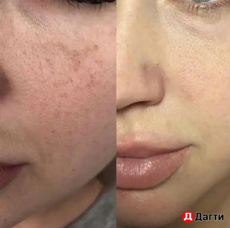 нужны модели косметологу