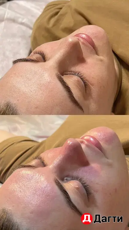 Модель на чистку лица и жидкий лазер