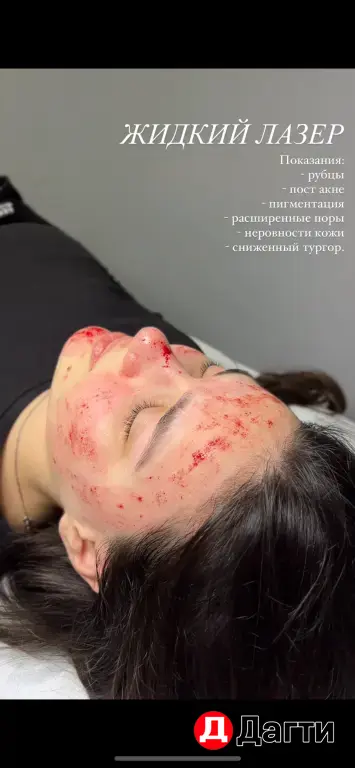 Модель на чистку лица и жидкий лазер