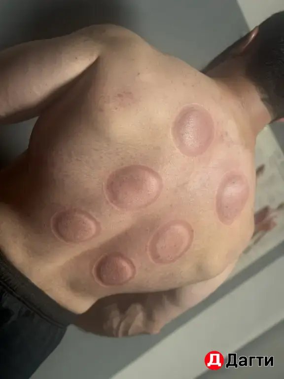 Массаж Взрослым и Детям